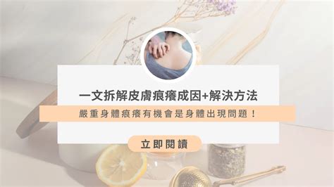 痕癢|皮膚痕癢解決方法｜皮膚痕癢原因+解決方法實測！擊退擾人膚況 